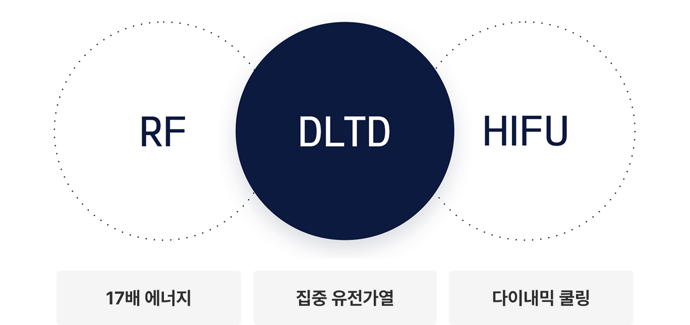 RF와 HIFU를 결합한 DLTD 기술 다이어그램