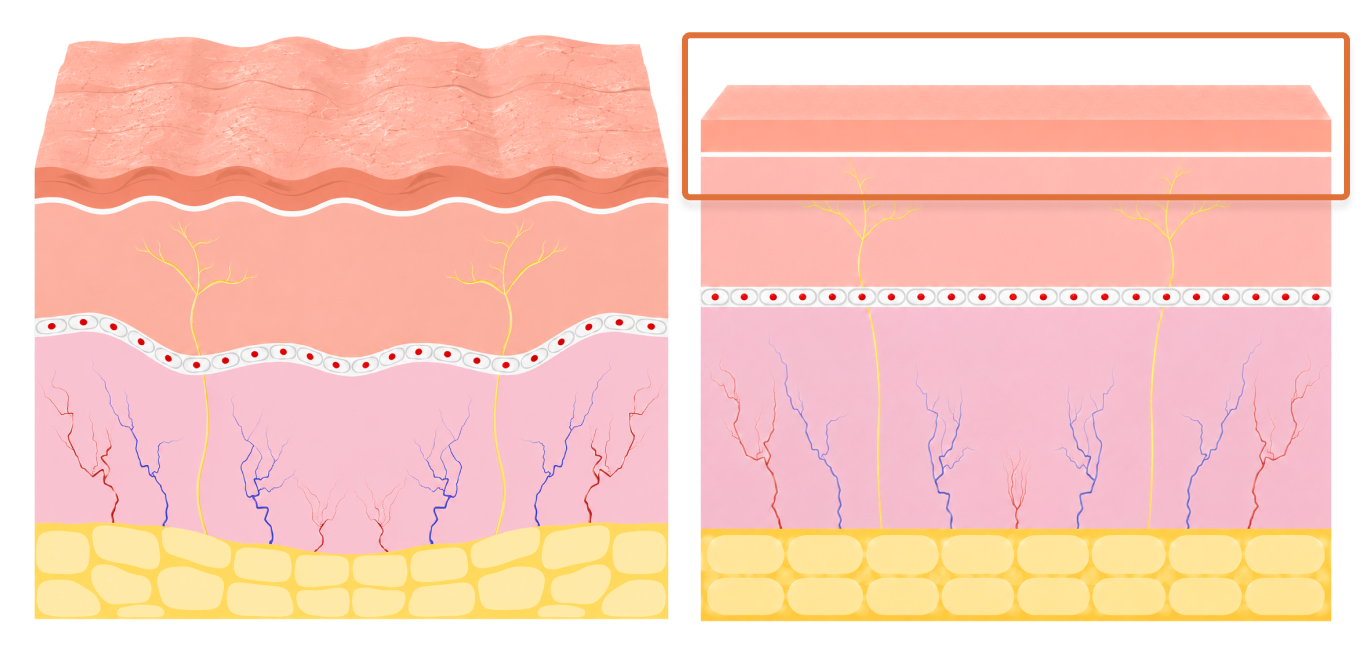 톡신 시술 전후 근육 움직임 비교 피부 단면 이미지