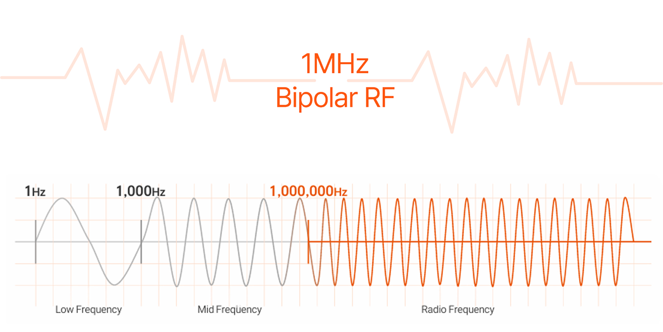 1MHz Bipolar RF 주파수 대역 비교 그래프
