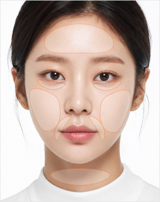 레티젠 시술 부위