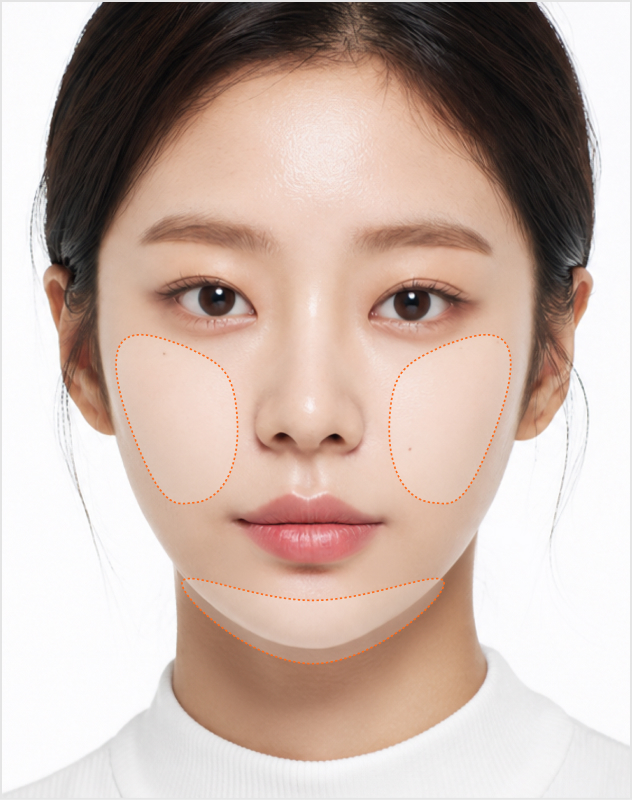 온다 시술 부위